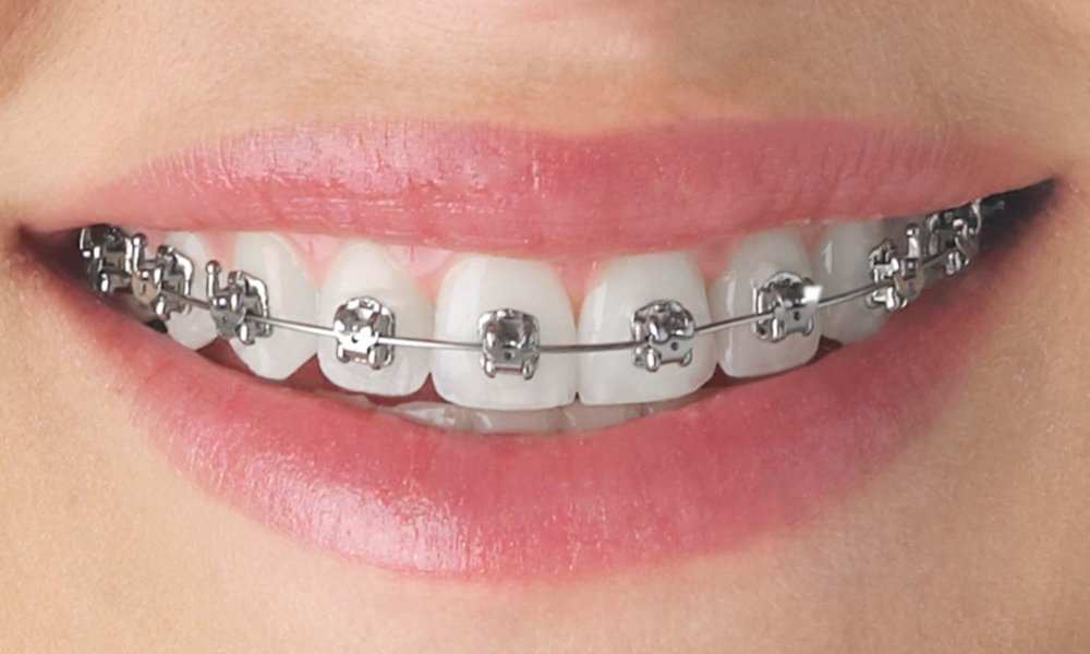 universal dental clinic kurali