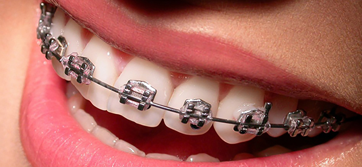 universal dental clinic kurali